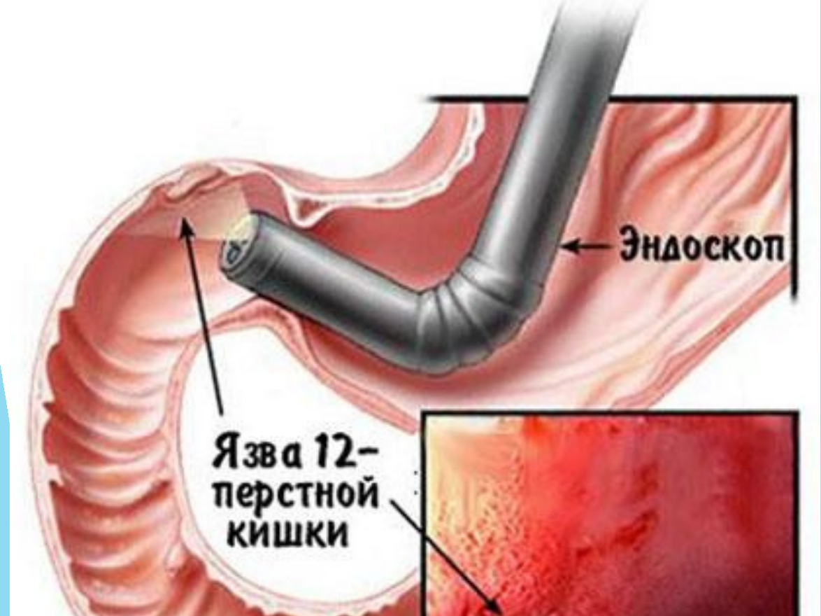 3-бет